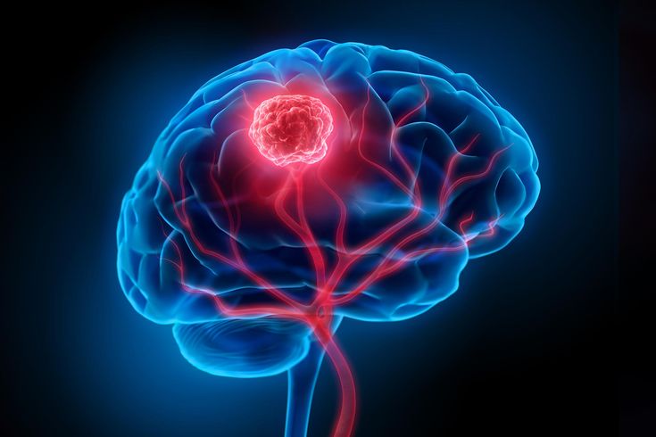 MedAyu Bhopal Neuro Care